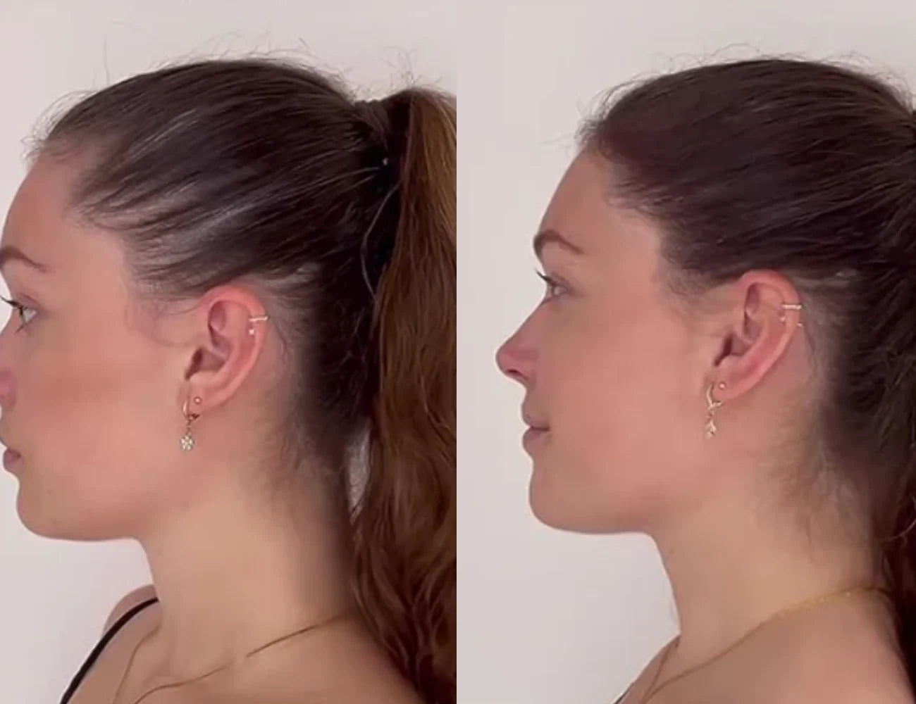 Lustrao Complete Regrowth System – (Shampoo, Conditioner, Öl, Scalp Massager & Derma Roller)